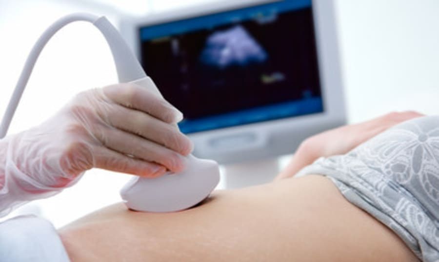 5 weeks ultrasound